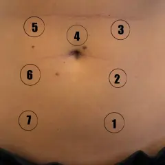 Close-up of a person's abdomen with numbered circles indicating points on the skin.