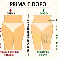 Diagram comparing "before" (cellulite, inflamed tissue) and "after" (smooth skin, healthy tissue) of professional massage.