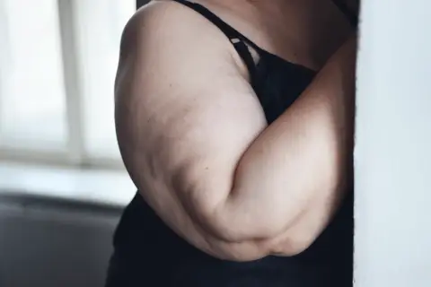 Primo piano di braccia con cellulite, in lingerie nera, con luce soffusa da una finestra.