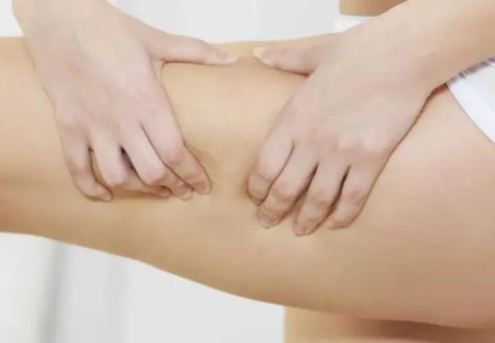 Mani che pizzicano la pelle per valutare il rilassamento cutaneo delle gambe.