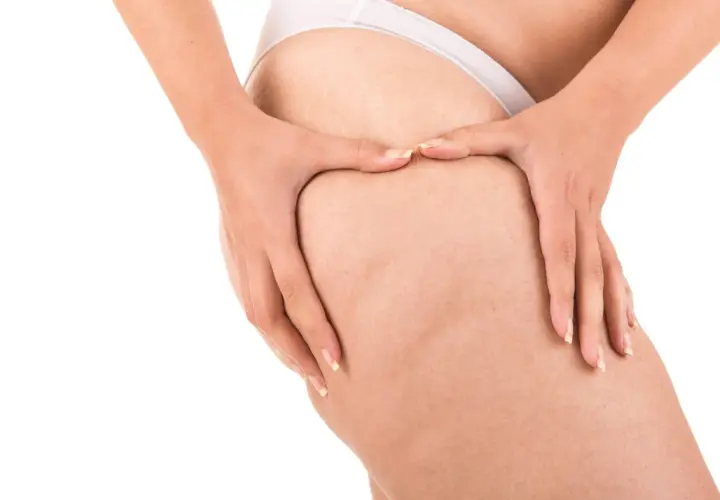 Mani che stringono la coscia, mostrando la texture della pelle e i noduli di cellulite, in un gesto che evoca il desiderio di rompere i noduli di cellulite.
