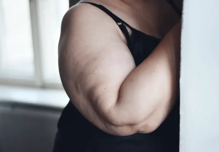 Primo piano di braccia con cellulite, in lingerie nera, con luce soffusa da una finestra.