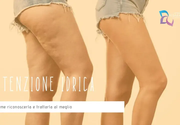 Gambe con cellulite e gonfiore, un effetto che può far sentire come se si avessero 4 kg di ritenzione idrica. Scopri come riconoscerla e trattarla.