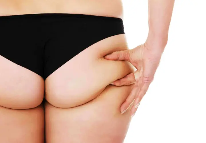 Mano che pizzica la pelle sui glutei, mostrando i banana rolls.