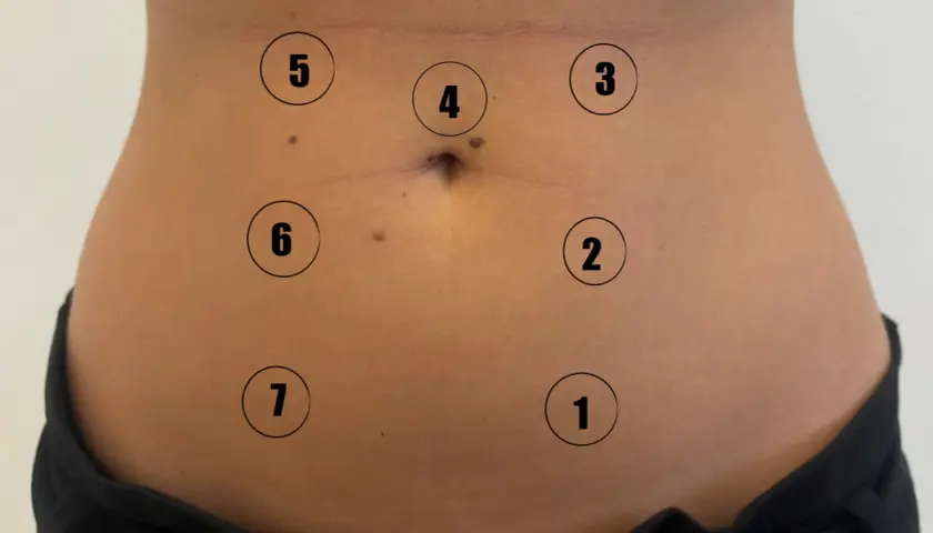 Close-up of a person's abdomen with numbered circles indicating points on the skin.