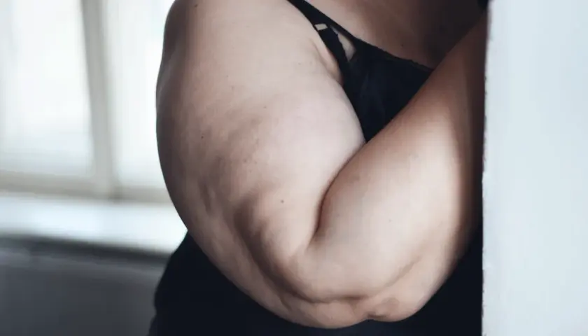Primo piano di braccia con cellulite, in lingerie nera, con luce soffusa da una finestra.