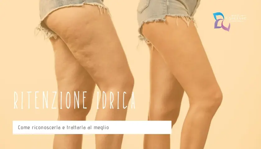 Gambe con cellulite e gonfiore, un effetto che può far sentire come se si avessero 4 kg di ritenzione idrica. Scopri come riconoscerla e trattarla.