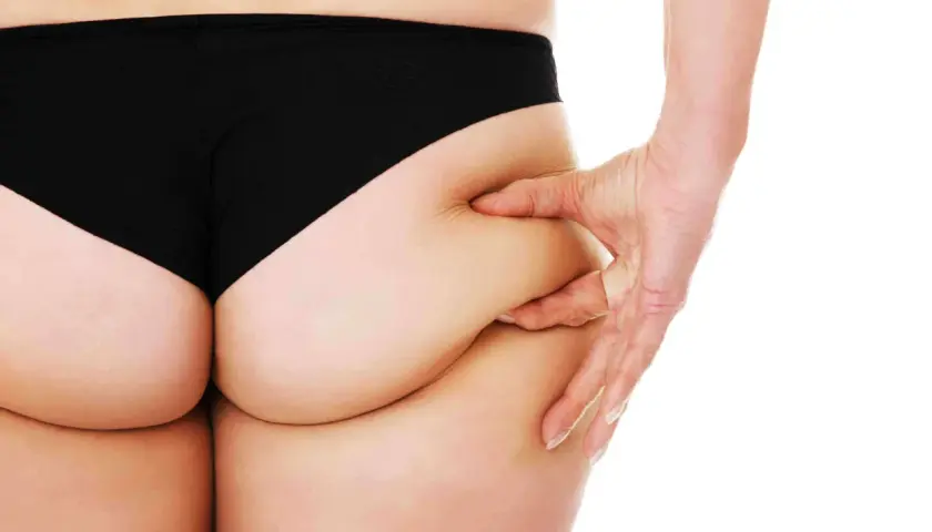 Mano che pizzica la pelle sui glutei, mostrando i banana rolls.