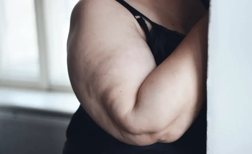 Cellulite sulle braccia - Cause, rimedi e cosa funziona davvero