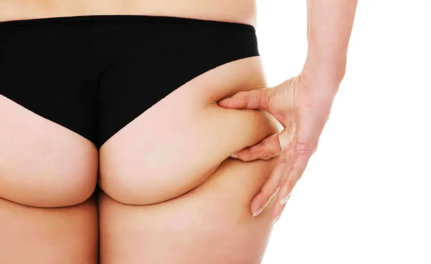 Banana rolls glutei: come ridurli davvero?