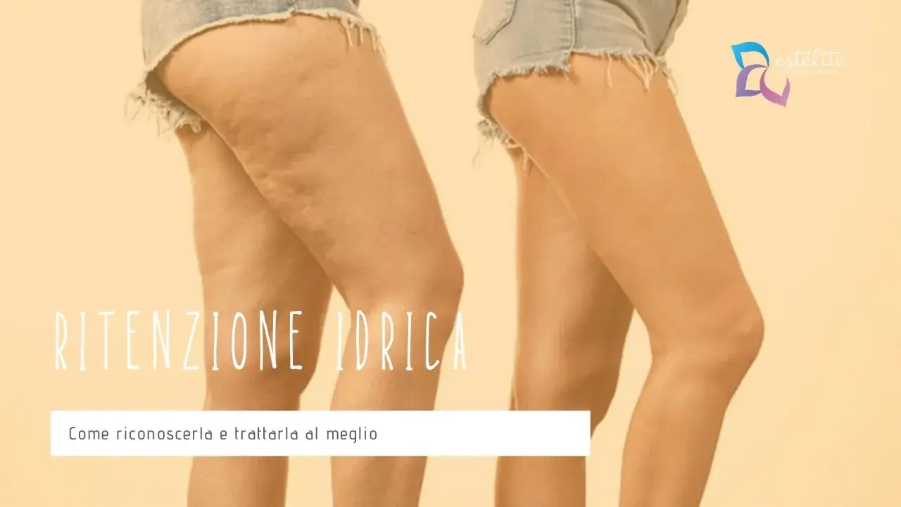 Gambe con cellulite e gonfiore, un effetto che può far sentire come se si avessero 4 kg di ritenzione idrica. Scopri come riconoscerla e trattarla.