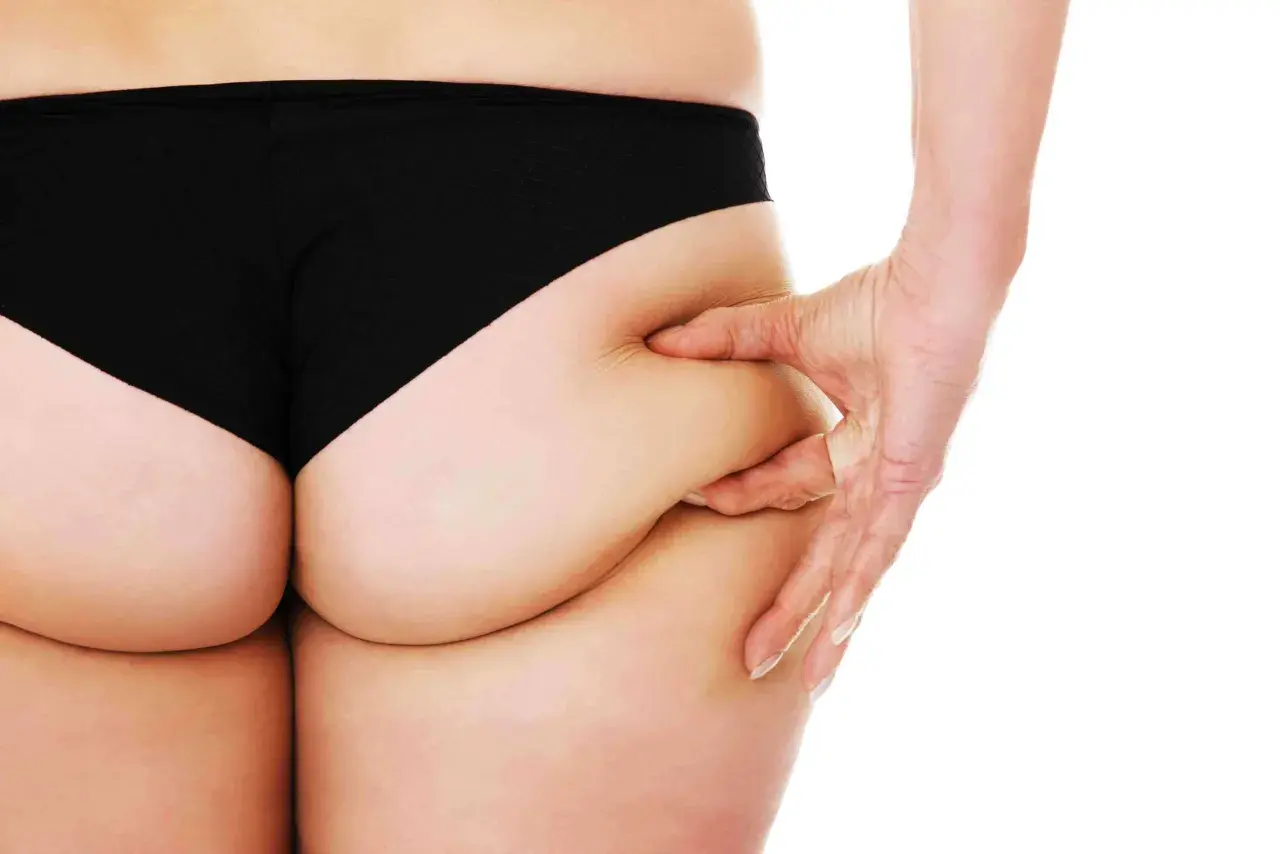 Mano che pizzica la pelle sui glutei, mostrando i banana rolls.