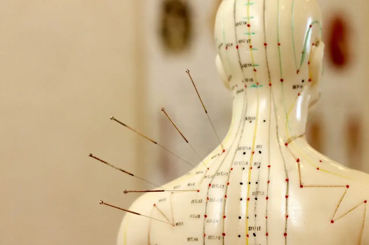 Modello anatomico per agopuntura con aghi inseriti sulla schiena. Il modello mostra i meridiani e i punti di agopuntura, con particolare attenzione ai punti del CV 17.