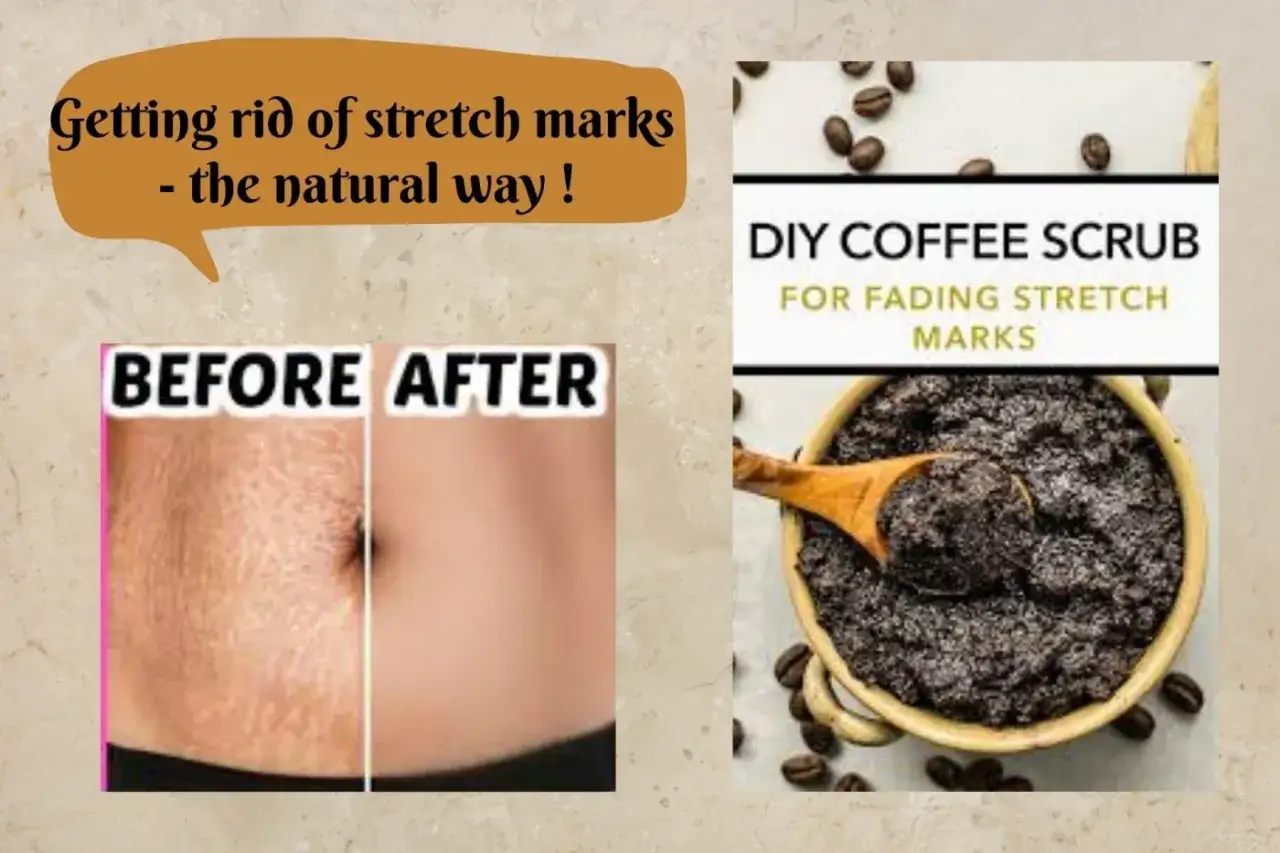 Scrub al caff&egrave; fai-da-te per attenuare il rilassamento cutaneo delle gambe e le smagliature. Prima e dopo.
