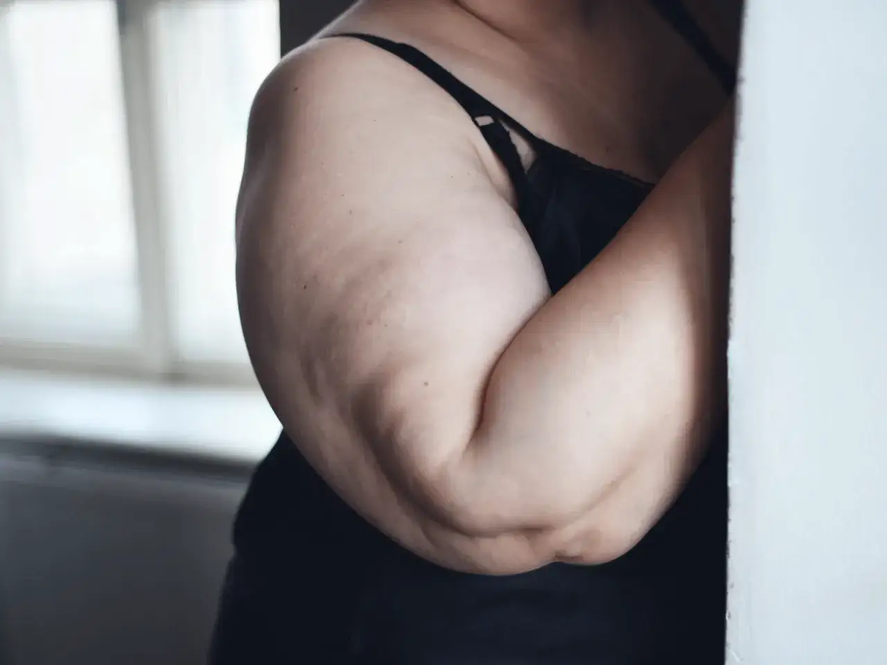 Primo piano di braccia con cellulite, in primo piano la pelle con texture visibile.